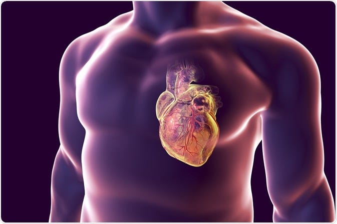 What is Myocarditis?