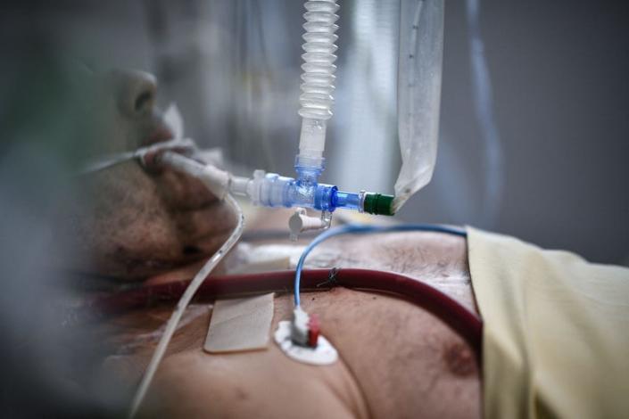 A severely sick covid-19 patient at a French hospital.