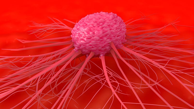 Study of Beliefs About What Causes Cancer Sparks Debate Study of Beliefs About What Causes Cancer Sparks Debate