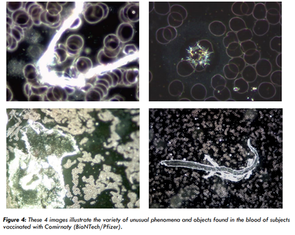 Image: Over 60 scientists call for an end to covid-19 “vaccines” after documenting foreign toxins that damage the blood and impede circulation