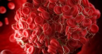 TAINTED BLOOD: 80% of the blood supply contaminated with spike proteins from mRNA jabs, blood banks accidentally admit