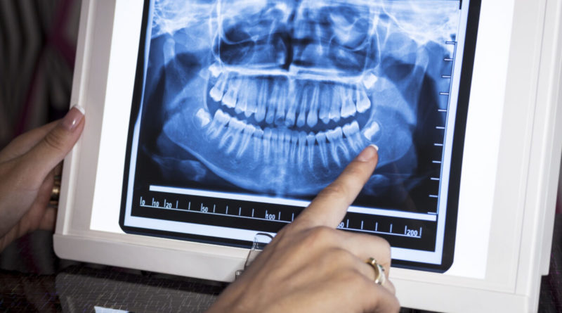 Dentists: Unexplained Pain, Tooth Loss and Bone Problems May Be Linked to COVID-19 Vaccine