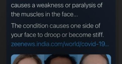 Did 4 COVID-19 Vaccine Trial Patients Develop Bell's Palsy?