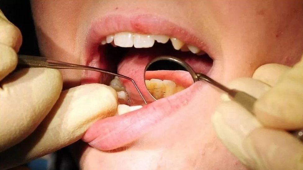 A dentist using equipment to check teeth