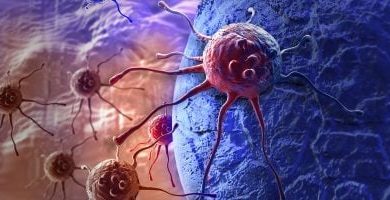 Gallbladder Cancer: Why Are COVID-19 mRNA Vaccinated Getting These Types of Turbo Cancers? - Global Research