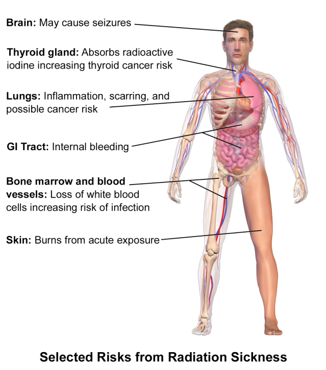 Symptoms of Radiation Poisoning