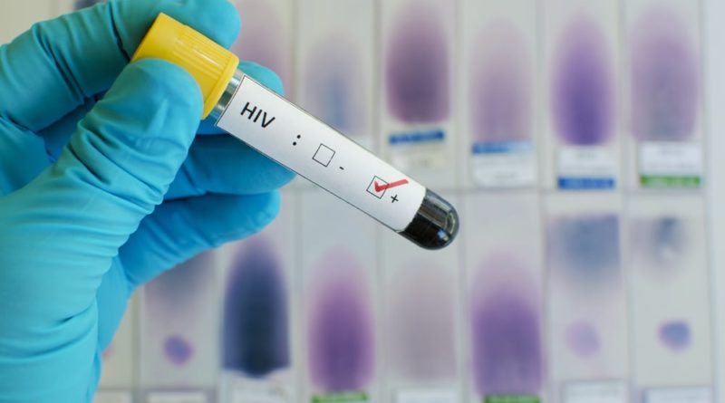 The myth goes on: HIV cure breakthrough as scientists find way of eliminating AIDS-causing virus