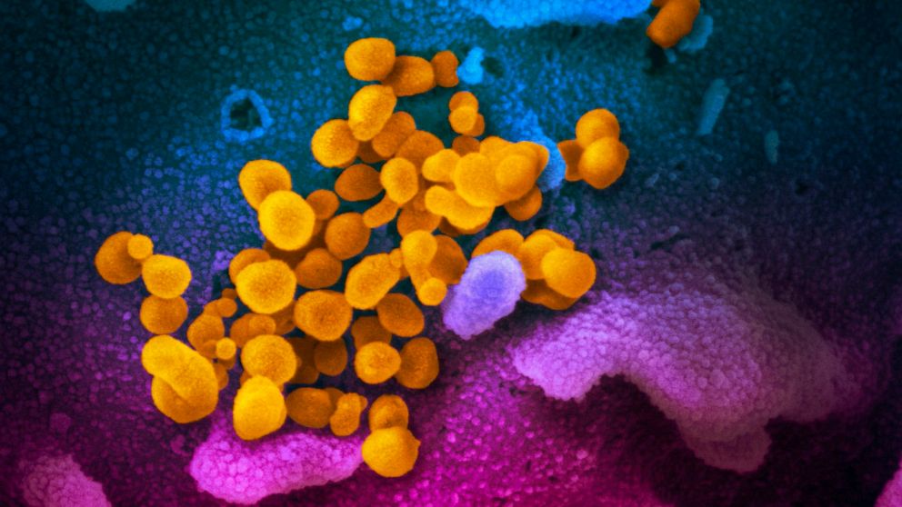 PHOTO: This handout illustration image taken with a scanning electron microscope shows SARS-CoV-2 (yellow)also known as 2019-nCoV, the virus that causes COVID-19isolated emerging from the surface of cells (blue/pink) cultured in the lab.