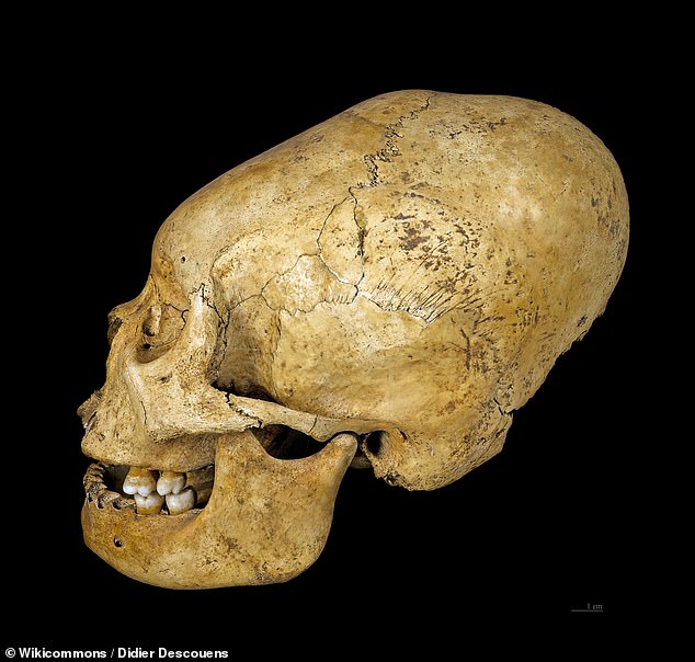 Above, one example of a deliberate deformity of the skull from a Proto-Nazca culture in Peru, dated to between 200 and 100 BC - and now stored by the Muséum de Toulouse in France. Many skeptics suspect the 'beings' were once practitioners of ancient 'head-binding' practices