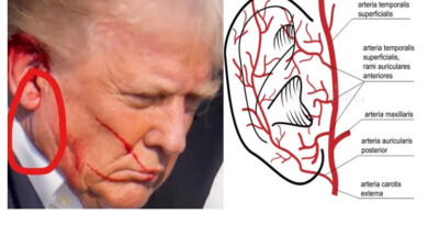 Trump’s Ear: You Decide