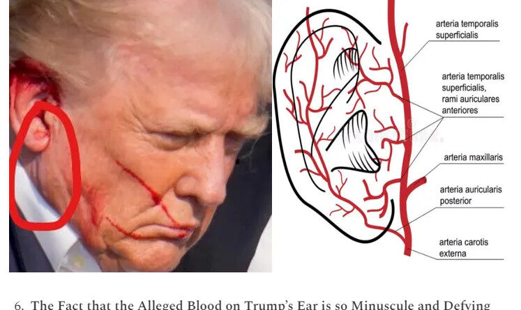 Trump’s Ear: You Decide