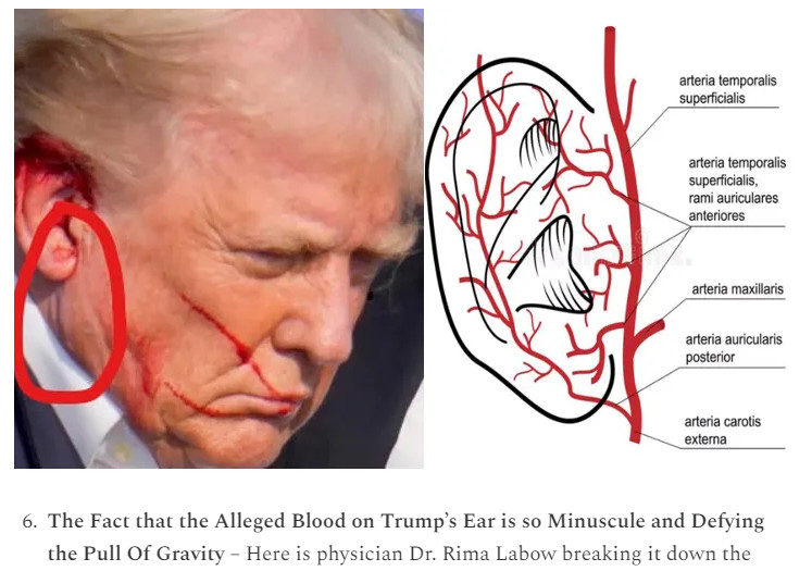 Trump Ear 2