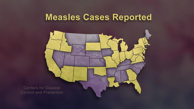 measles-cases-reported.jpg 