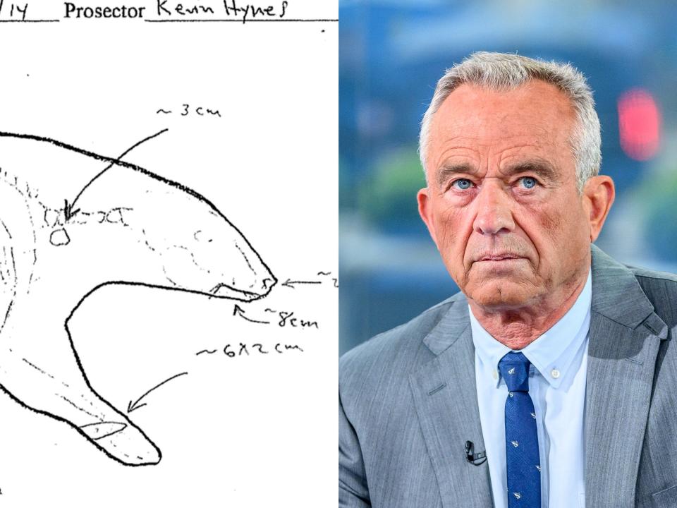 A composite photo of the Central Park bear's autopsy diagram and RFK Jr. in a suit.